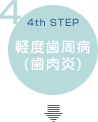 軽度歯周病(歯肉炎)